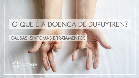 DOENÇA DE DUPUYTREN